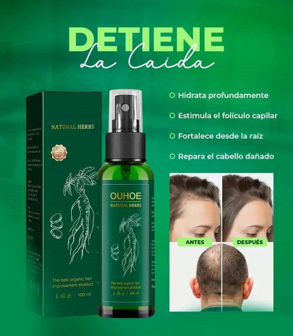 OUHOE® – Tónico para el crecimiento del cabello.